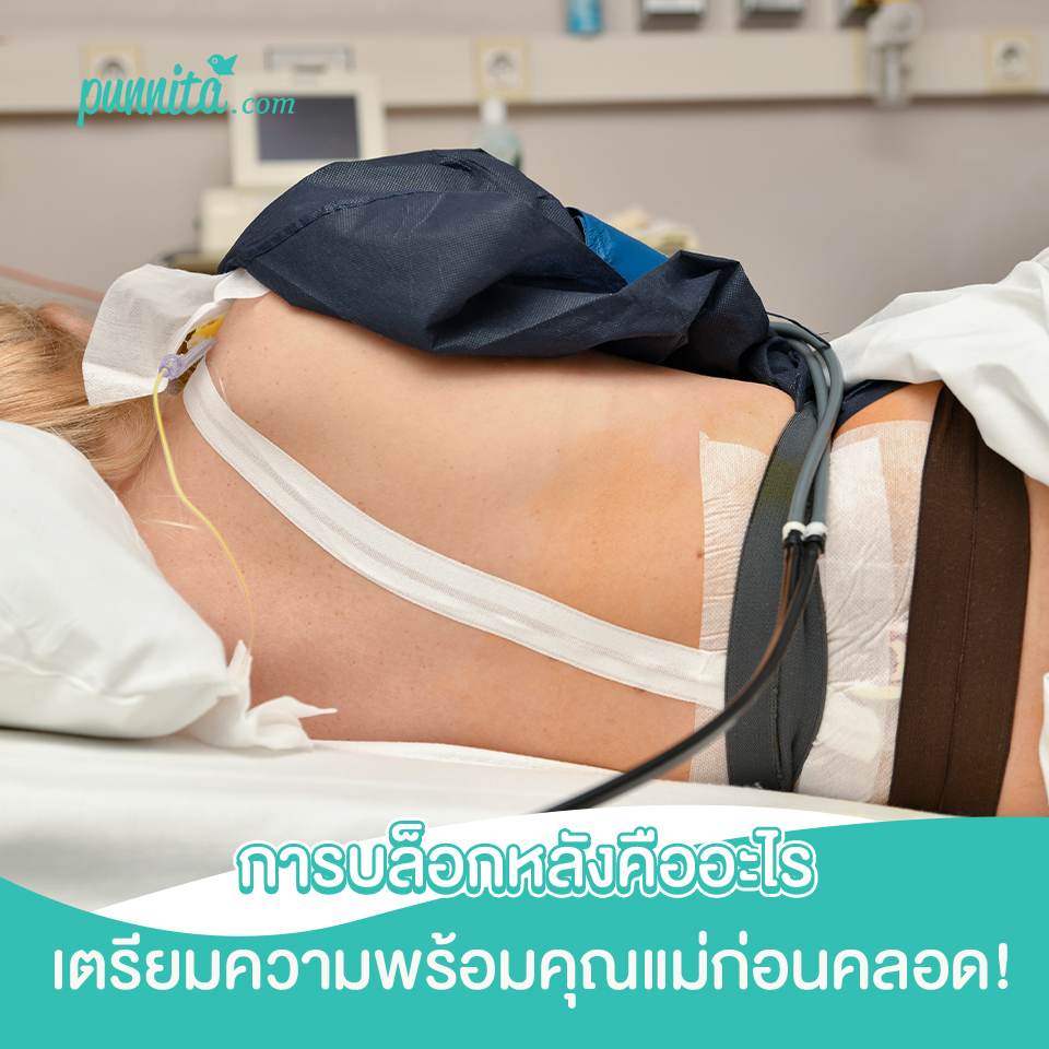 การบล็อกหลังคืออะไร เตรียมความพร้อมคุณแม่ก่อนคลอด!